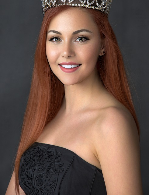 球队需要在 球队需要在